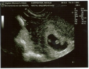mormon-woman-discovers-twins-pregnancy mormon-mom-shares-miracle-with-twin-pregnancy